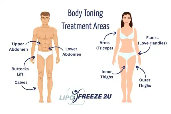 Graphic showing where you can have Body toning Treatment Chiswick on your body