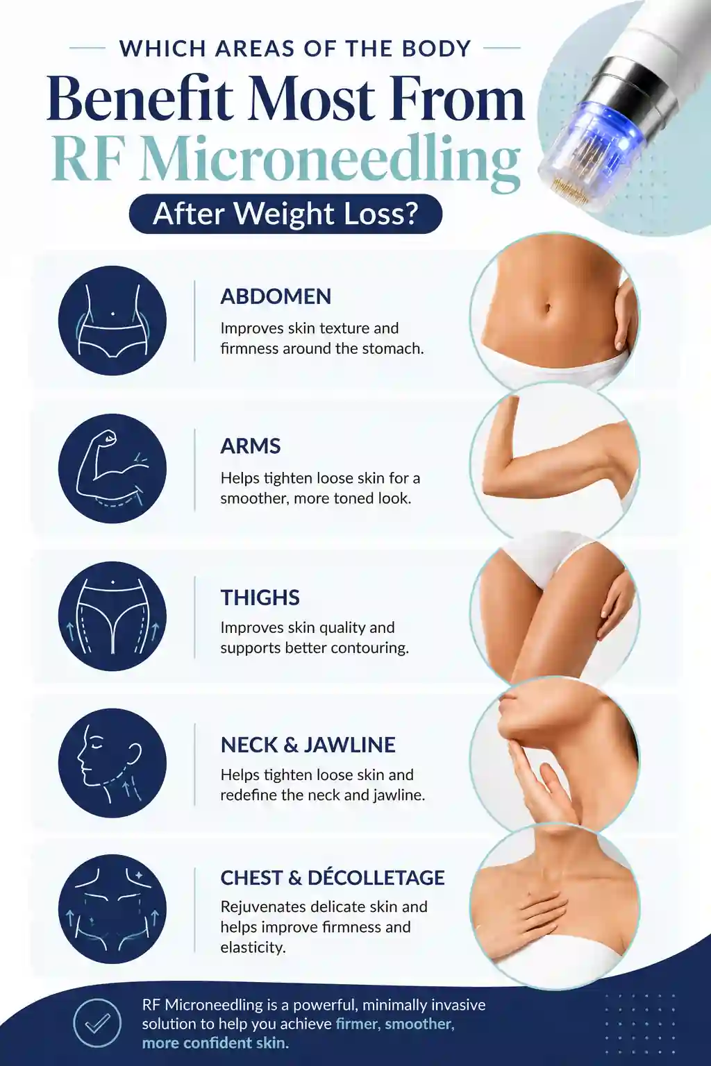 Which Areas of the Body Benefit Most From RF Microneedling After Weight Loss Chiswick